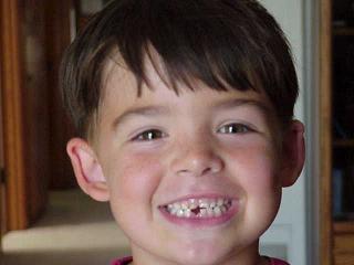 matthew lost his tooth.JPG